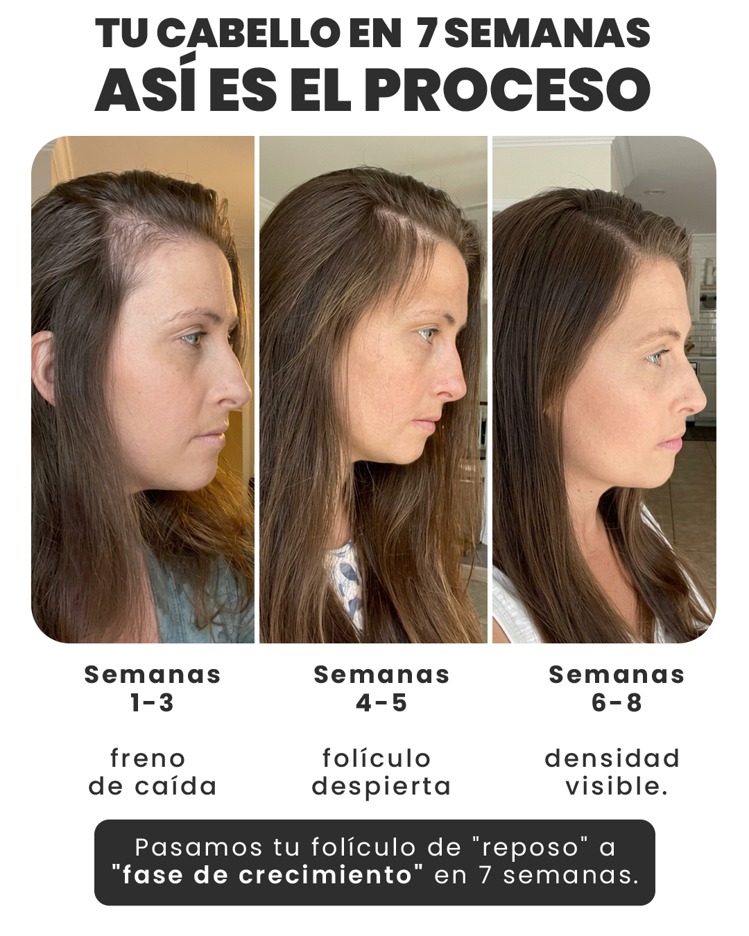 Suplemento interno anticaída Dermafol