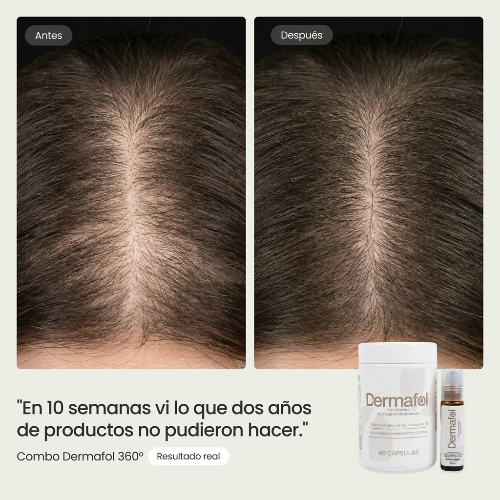 Combo Dermafol 360°