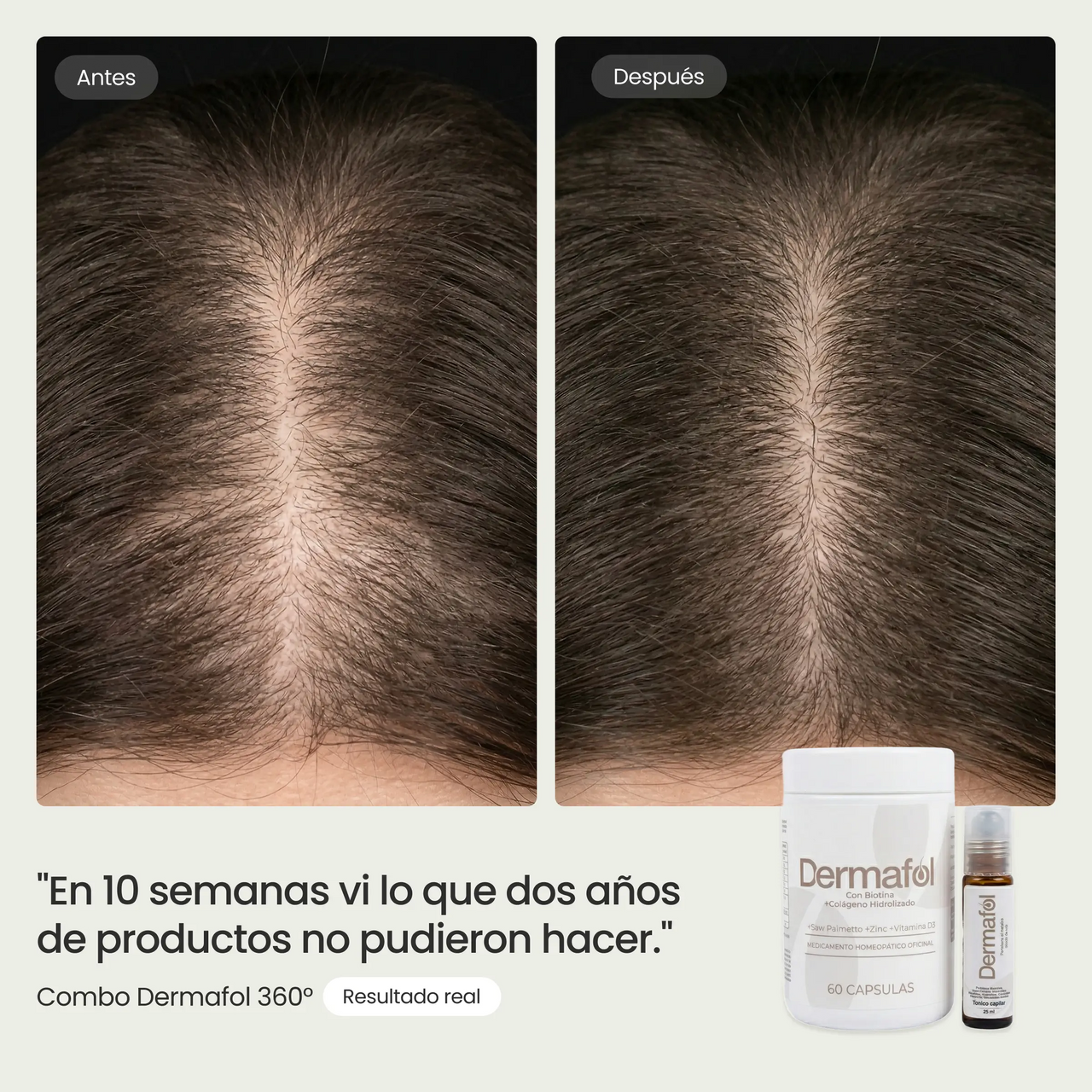 Combo Dermafol 360°