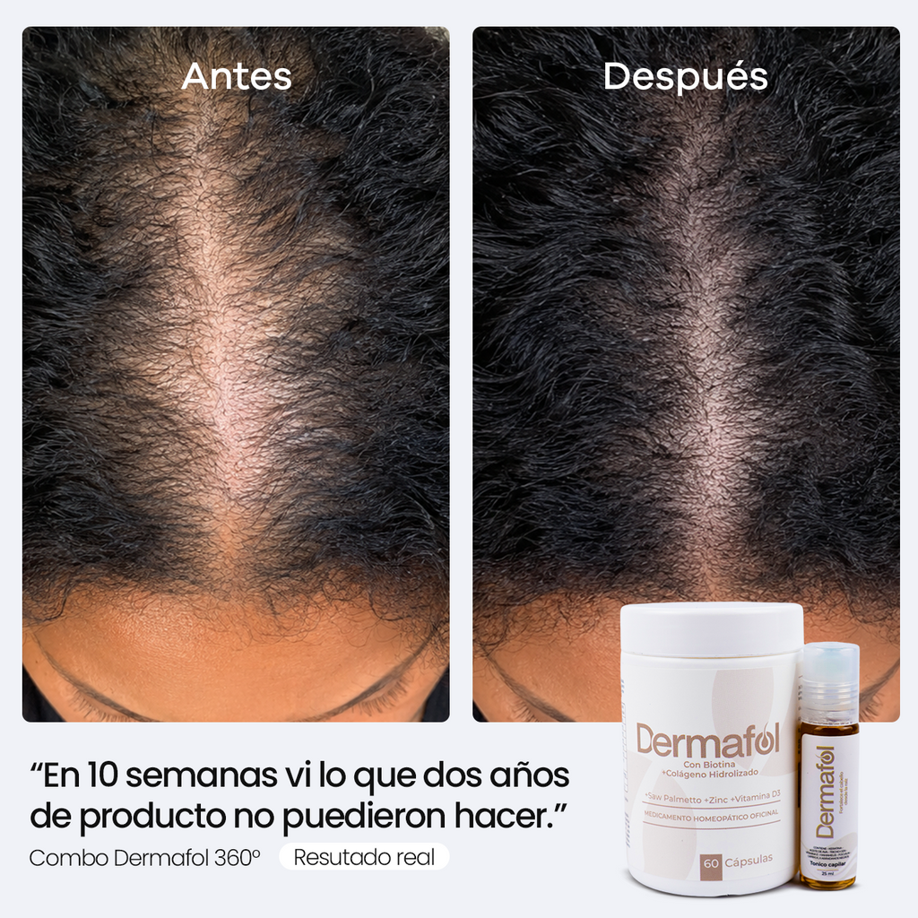 Combo Dermafol 360° | Para todo tipo de pelo