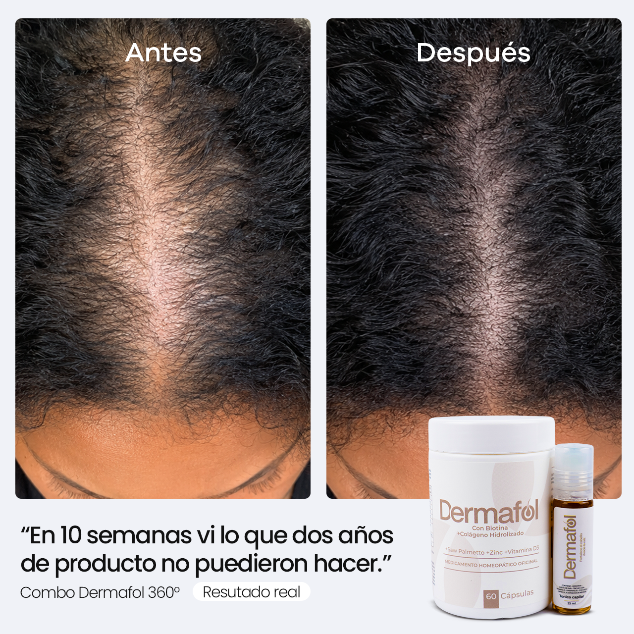Combo Dermafol 360° | Para todo tipo de pelo